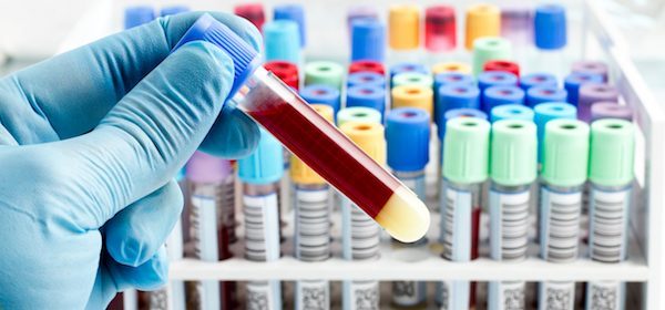 Regular Blood Testing: Getting the Real Score of Your Wellness Game